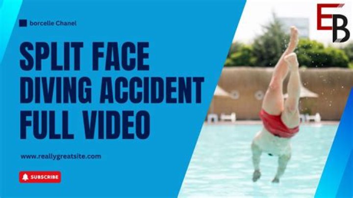 Diving Face Split Incident: A Deep Dive into the Tragic Event