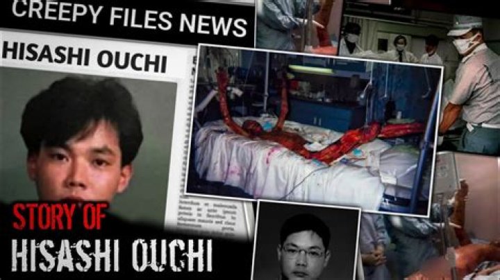Hisashi Ouchi Real Photo: The Tragic Story Behind the Iconic Image