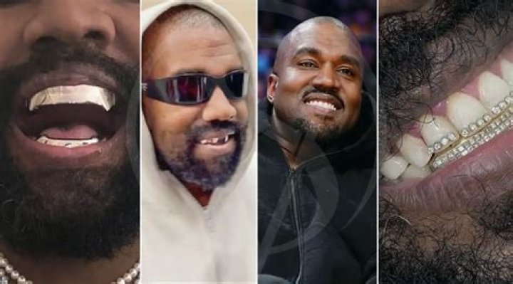 Kanye West Teeth: The Transformation of a Music Icon