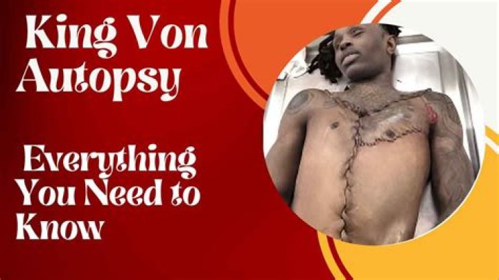 King Von Autopsy: Understanding the Tragedy and Its Impact