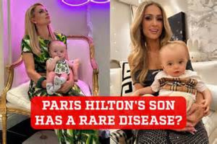 Understanding Paris Hilton's Son Condition: A Comprehensive Overview