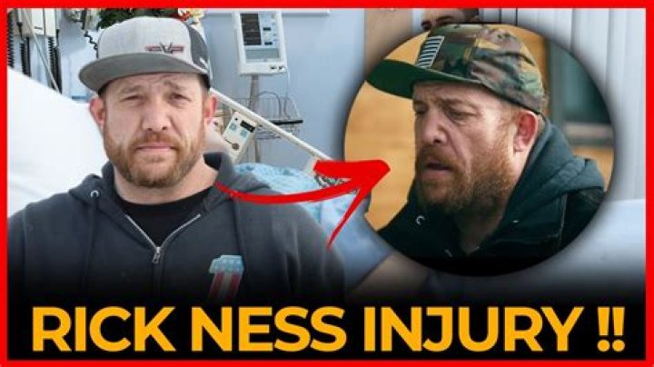 Understanding Rick Ness Nose: A Deep Dive into the Iconic Look
