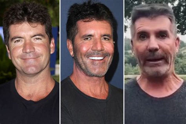 Understanding Simon Cowell's Son's Disability: A Compassionate Insight
