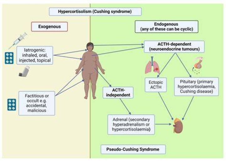 Understanding VATER Syndrome: Causes, Diagnosis, and Management