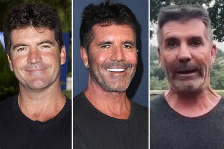 What Condition Does Simon Cowell's Son Have? Understanding Eric Cowell's Health Journey